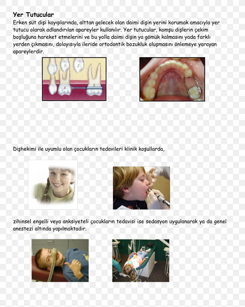 Nitrous Oxide Sedation Organism, PNG, 745x1024px, Nitrous Oxide, Jaw, Joint, Organism, Oxide Download Free