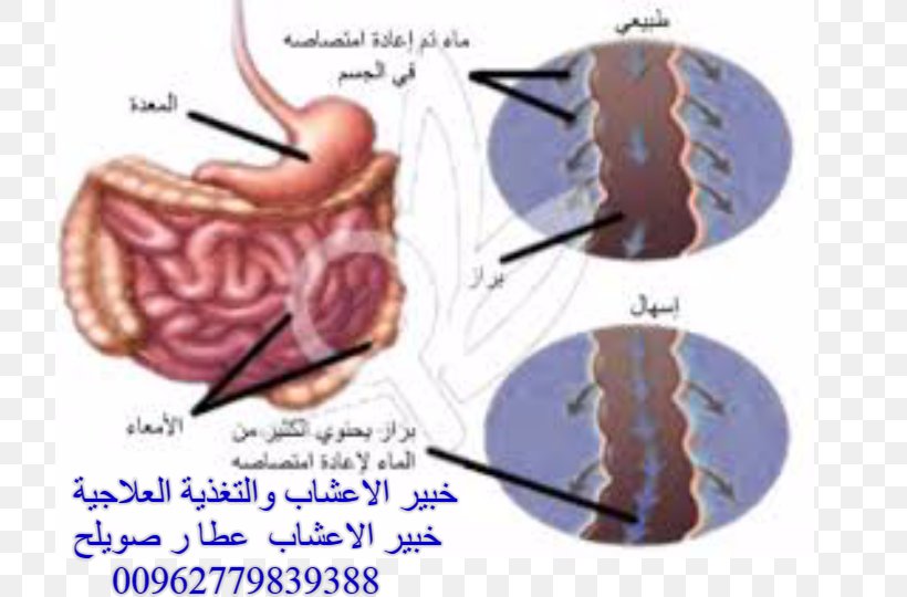 Diarrhea Therapy Child Herbalism Pathogenesis, PNG, 720x540px, Watercolor, Cartoon, Flower, Frame, Heart Download Free