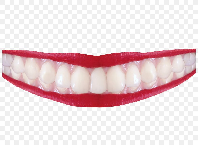 Human Tooth, PNG, 800x600px, Tooth, Human Tooth, Jaw, Lip, Mouth Download Free