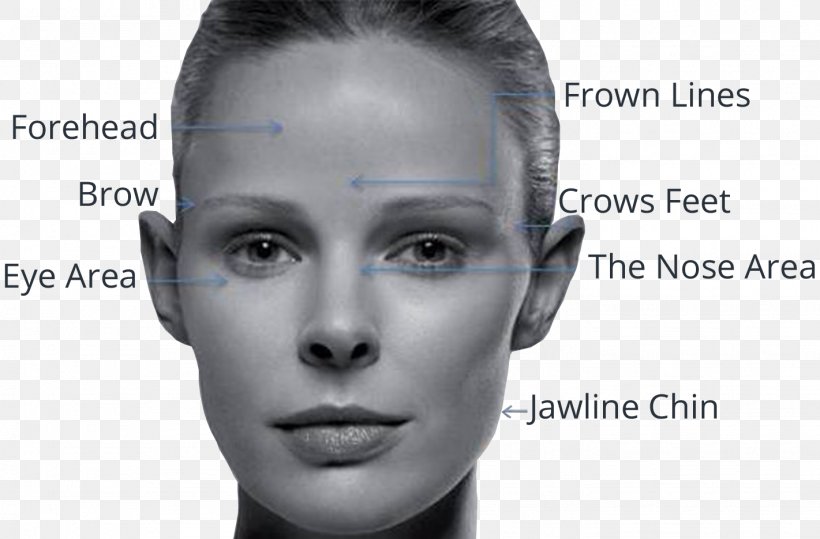 Forehead Wrinkle Cheek Skin Element Clinic Face, PNG, 1421x935px, Forehead, Antiaging Cream, Black And White, Cheek, Chin Download Free