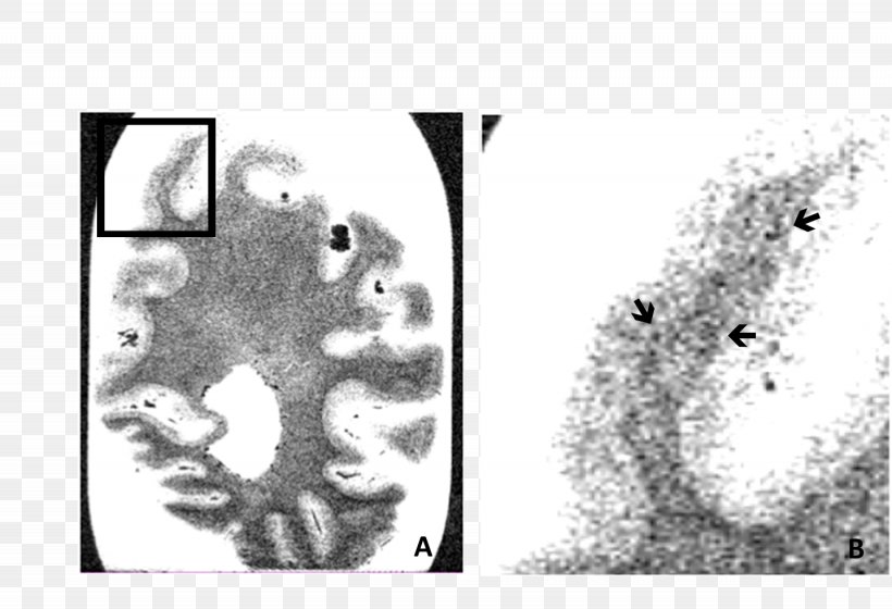 Occipital Lobe Lobes Of The Brain Temporal Lobe Cerebral Cortex Parietal Lobe, PNG, 1435x981px, Watercolor, Cartoon, Flower, Frame, Heart Download Free