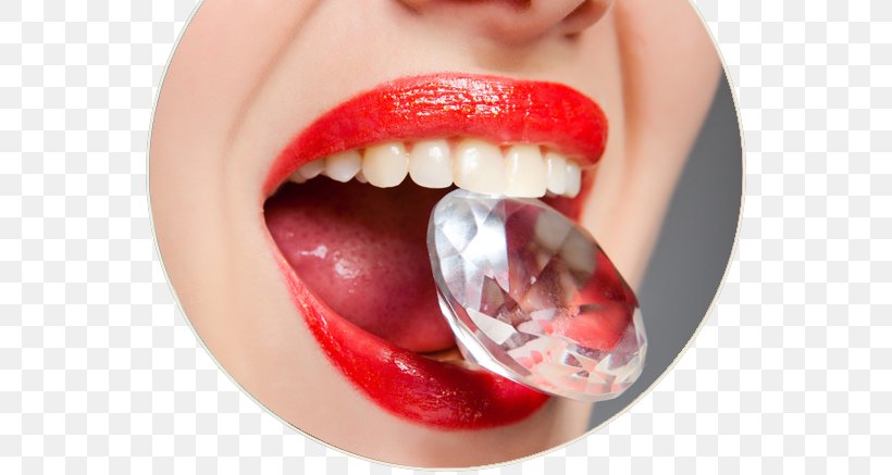 Tooth Brushing Dentistry Implant, PNG, 650x437px, Tooth, Aurum, Close Up, Cosmetic Dentistry, Dental Implant Download Free