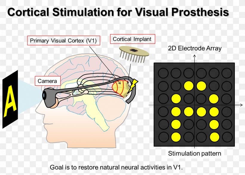 Visual Prosthesis Implant Microcoil Technology, PNG, 1446x1035px, Watercolor, Cartoon, Flower, Frame, Heart Download Free