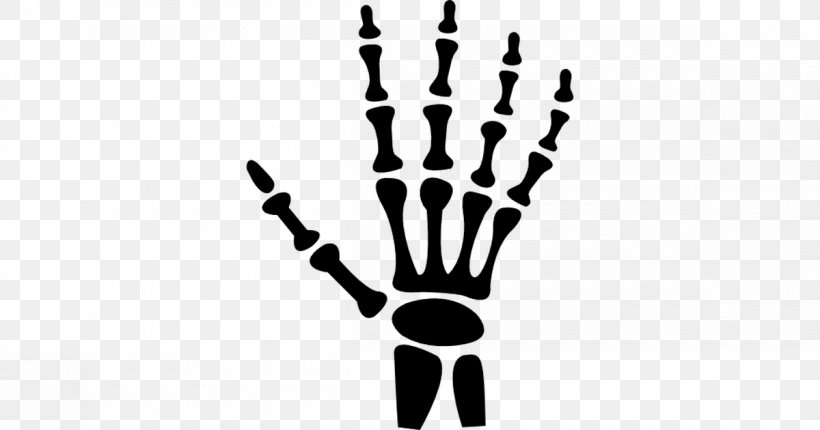 Human Skeleton Carpal Bones Hand Human Body, PNG, 1200x630px, Human Skeleton, Arm, Black And White, Bone, Branch Download Free