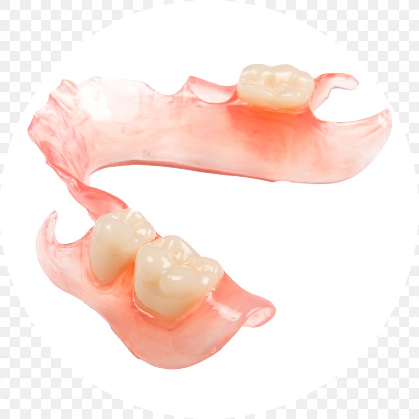 Dentures Dental Laboratory Dentistry Prosthesis, PNG, 1024x1024px, Dentures, Clear Aligners, Dental Laboratory, Dental Technician, Dentist Download Free