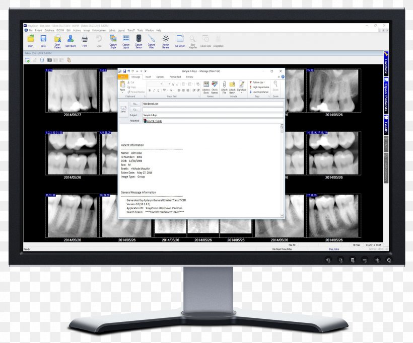 X-ray Vision Computer Monitors Computer Software Display Device Dental Radiography, PNG, 2168x1804px, Xray Vision, Apteryx Inc, Communication, Computer Monitor, Computer Monitor Accessory Download Free