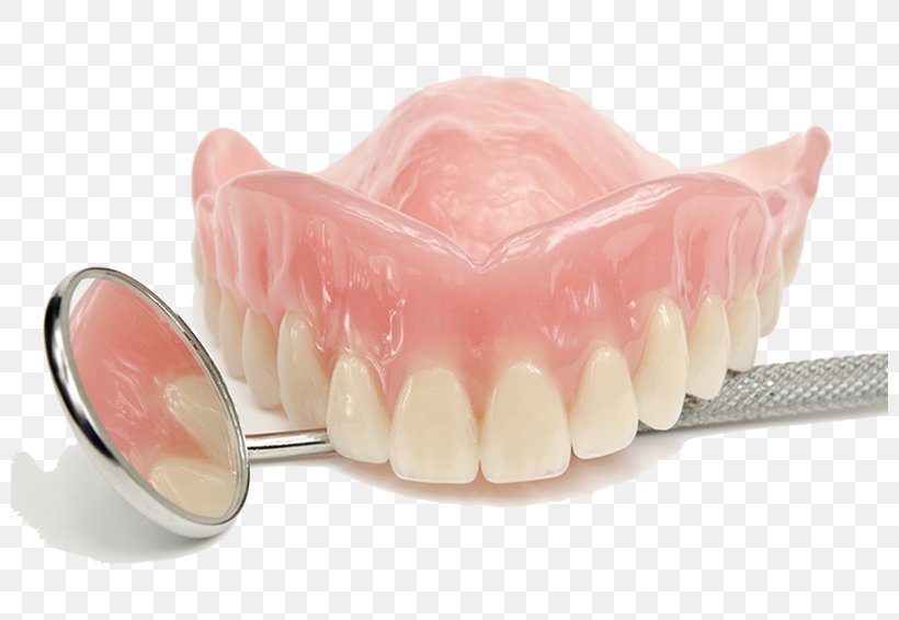 Dentures Prosthodontics Dentistry Tooth, PNG, 800x566px, Dentures, Cadcam Dentistry, Dental Implant, Dental Surgery, Dentist Download Free
