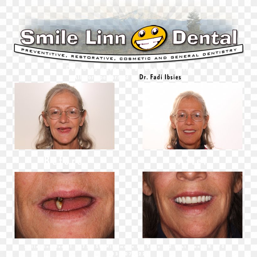 Smile Linn Dental: Ibsies Fadi B DMD Dentistry Lake Oswego Mouth, PNG, 900x900px, Dentist, Cheek, Chin, Cosmetic Dentistry, Dentistry Download Free