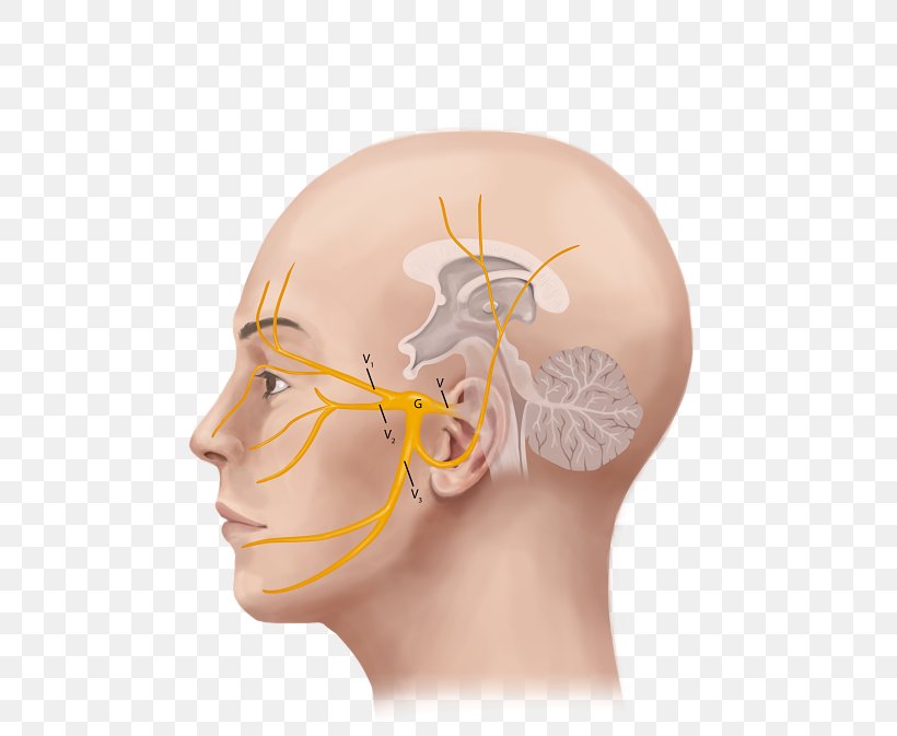 Trigeminal Nerve Trigeminal Neuralgia Headache, PNG, 520x673px, Watercolor, Cartoon, Flower, Frame, Heart Download Free