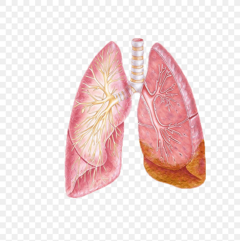 Non-small Cell Lung Cancer Bronchus, PNG, 587x824px, Watercolor, Cartoon, Flower, Frame, Heart Download Free