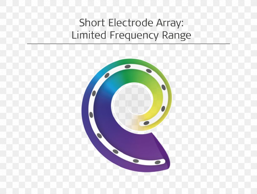 Electrode Array Hearing Loss Cochlear Implant MED-EL, PNG, 1657x1251px, Electrode, Brand, Cochlea, Cochlear Implant, Diagram Download Free