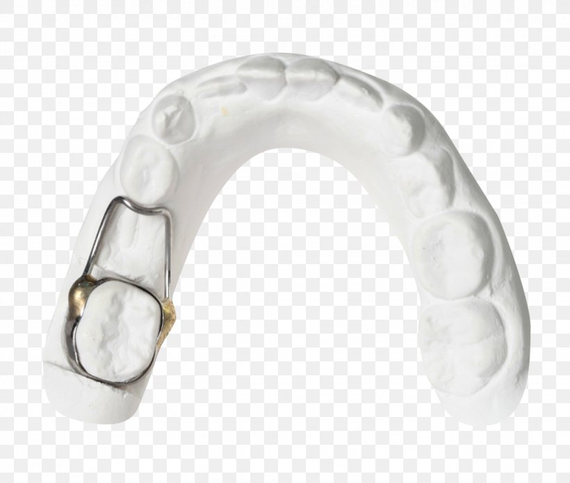 Tooth Whitening Mouth Dentistry Horse, PNG, 1024x869px, Tooth Whitening, Body Jewellery, Body Jewelry, Computer Hardware, Dentistry Download Free