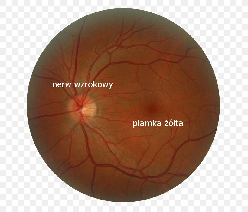 Macula Of Retina Eye Cone Cell Rod Cell, PNG, 700x700px, Retina, Blood Vessel, Cell, Cone Cell, Degeneration Download Free