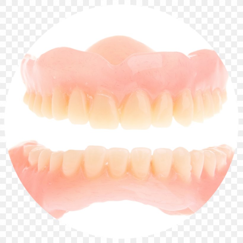 Human Tooth Dentures, PNG, 1024x1024px, Tooth, Dentures, Human Tooth, Jaw, Lip Download Free