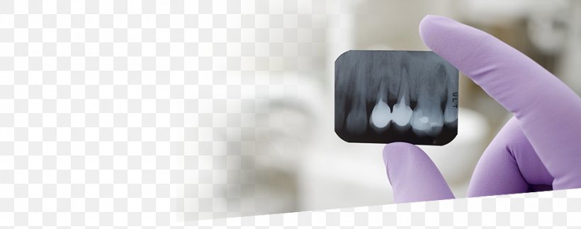 Dentistry Tooth ArseDent Therapy, PNG, 960x380px, Dentistry, Anesthesia, Brush, Clinic, Close Up Download Free