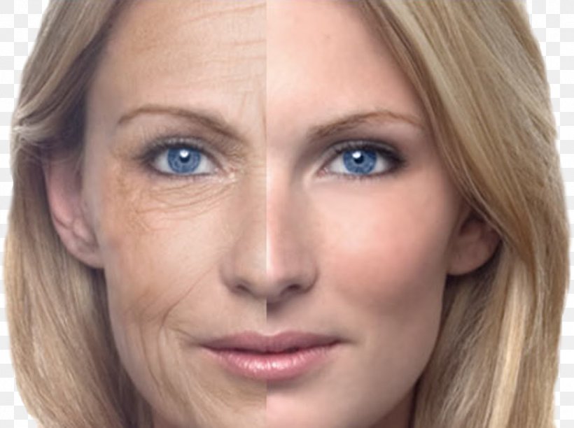 Ageing Skin Old Age Anti-aging Cream Wrinkle, PNG, 1295x967px, Ageing, Acne, Antiaging Cream, Beauty, Blond Download Free
