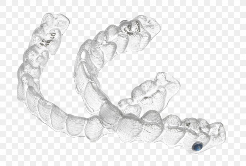 Clear Aligners Orthodontics Dental Braces Dentistry Therapy, PNG, 1374x933px, Clear Aligners, Adolescence, Body Jewelry, Bracelet, Chain Download Free