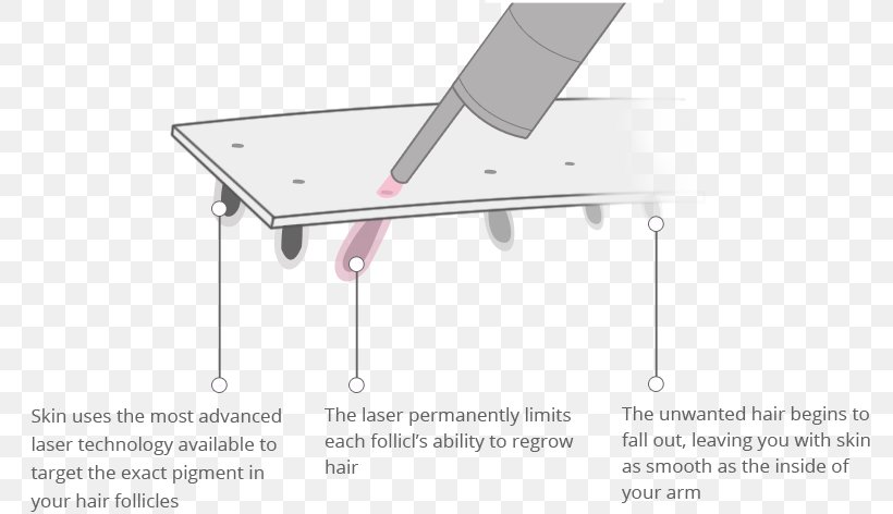 Laser Hair Removal Plucking Waxing, PNG, 792x472px, Hair Removal, Arm, Armhaar, Black Hair, Blond Download Free