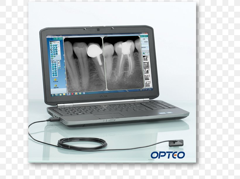 Dentistry Radiology Sensor Digital Radiography Dental Radiography, PNG, 639x612px, Dentistry, Dental Radiography, Digital Radiography, Endodontic Therapy, Equipo Dental Download Free