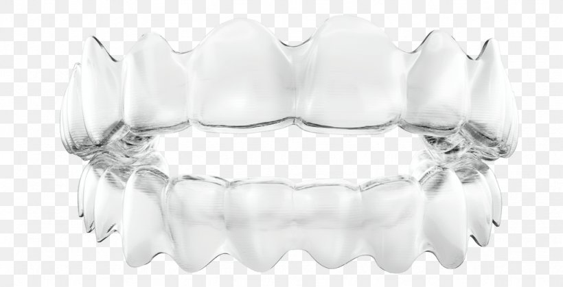 Clear Aligners Orthodontics Dental Braces Dentistry Tooth, PNG, 1024x522px, Clear Aligners, Black And White, Body Jewelry, Bracelet, Dental Braces Download Free