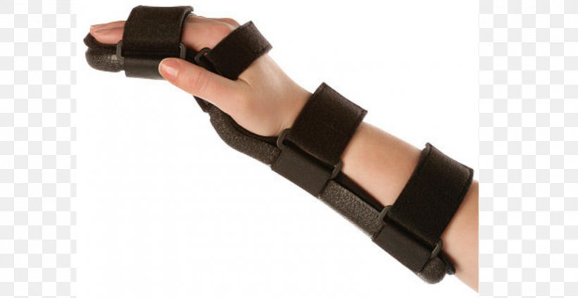 Thumb Splint Wrist Orthotics Hand, PNG, 1600x827px, Thumb, Arm, Carpal Bones, Digit, Finger Download Free