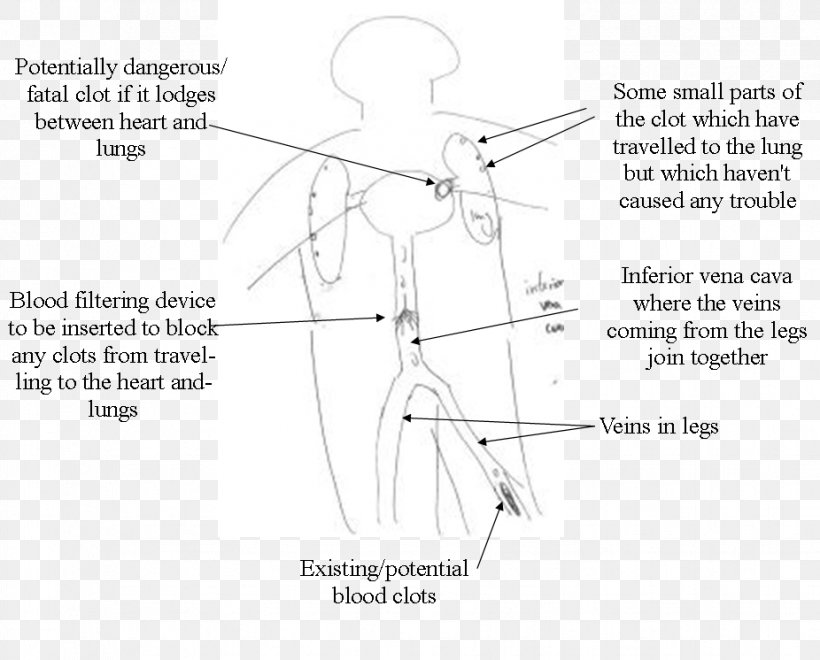 Drawing Product Design Diagram Point, PNG, 926x746px, Watercolor, Cartoon, Flower, Frame, Heart Download Free