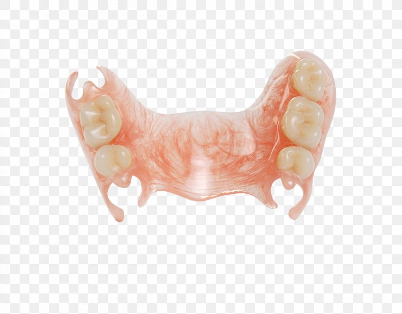 Deflex Tooth Empresa Virodent System, PNG, 1200x940px, Deflex, Americas, Argentina, Buenos Aires, Empresa Download Free