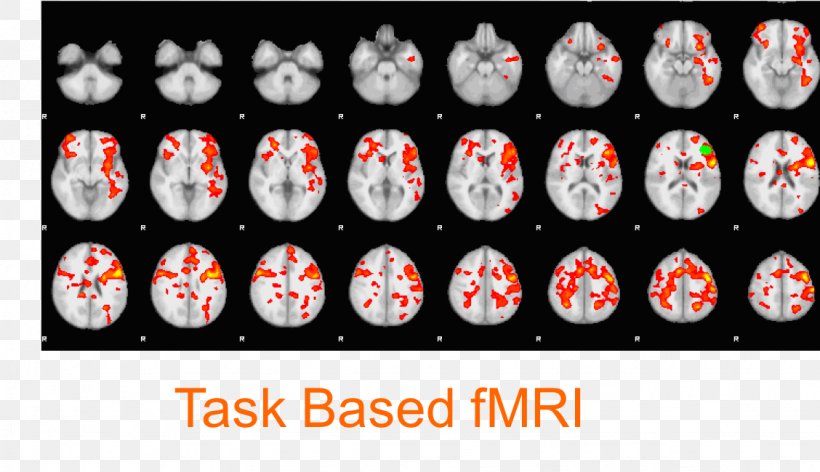 Functional Magnetic Resonance Imaging Brain Default Mode Network Functional Neuroimaging, PNG, 1128x650px, Magnetic Resonance Imaging, Brain, Default Mode Network, Functional Neuroimaging, Health Download Free