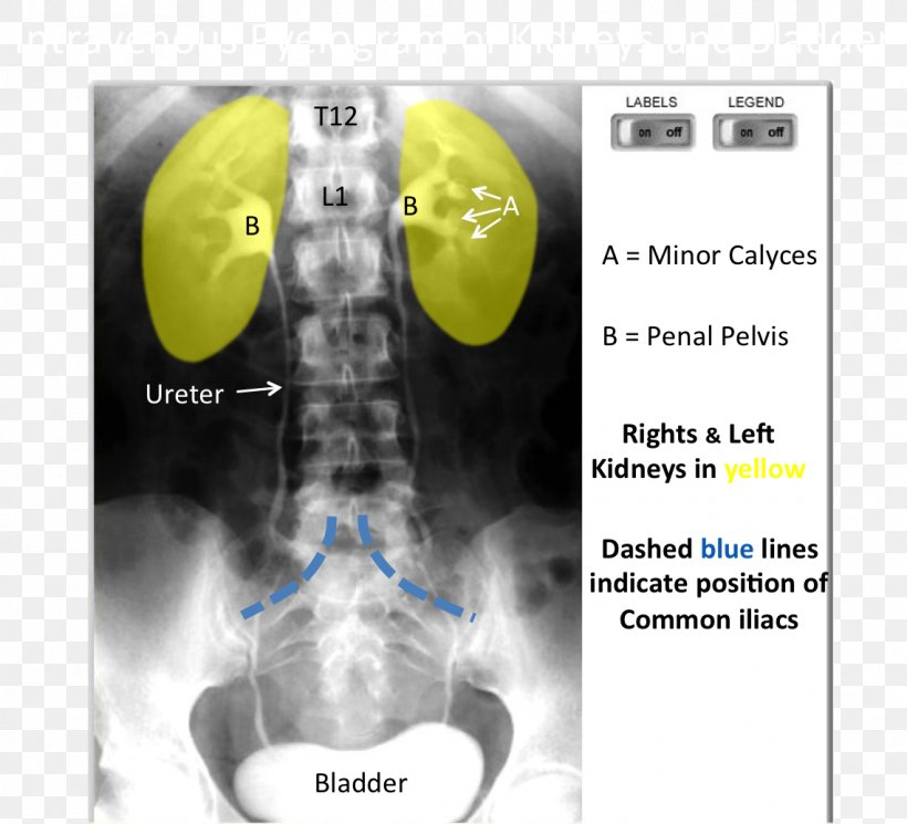 Medical Imaging Radiology X-ray Medicine, PNG, 1141x1038px, Medical Imaging, Jaw, Magnetic Resonance Imaging, Medical, Medicine Download Free