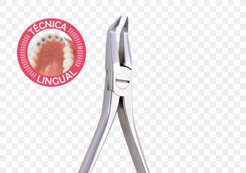Lingual Braces Dental Braces, PNG, 900x636px, Lingual Braces, Dental Braces, Nipper, Tool Download Free