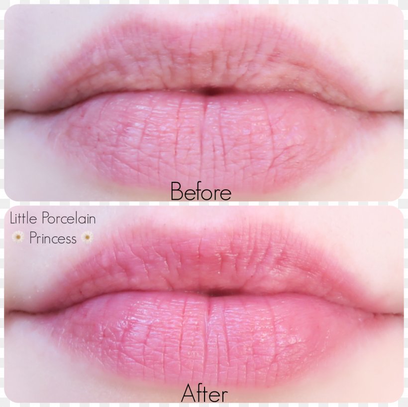 Lip Stain Lipstick Etude House Lip Gloss, PNG, 1600x1600px, Lip, Close Up, Cosmetics, Etude House, Infant Download Free