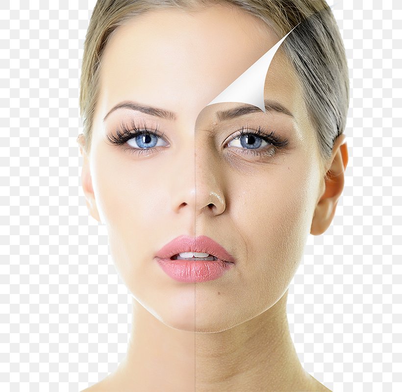 Chemical Peel Skin Care Exfoliation Facial, PNG, 800x800px, Chemical Peel, Antiaging Cream, Beauty, Cheek, Chin Download Free