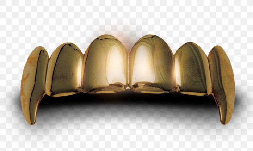 Gold Teeth Human Tooth, PNG, 1000x600px, Gold Teeth, Brass, Dentures, Furniture, Gold Download Free
