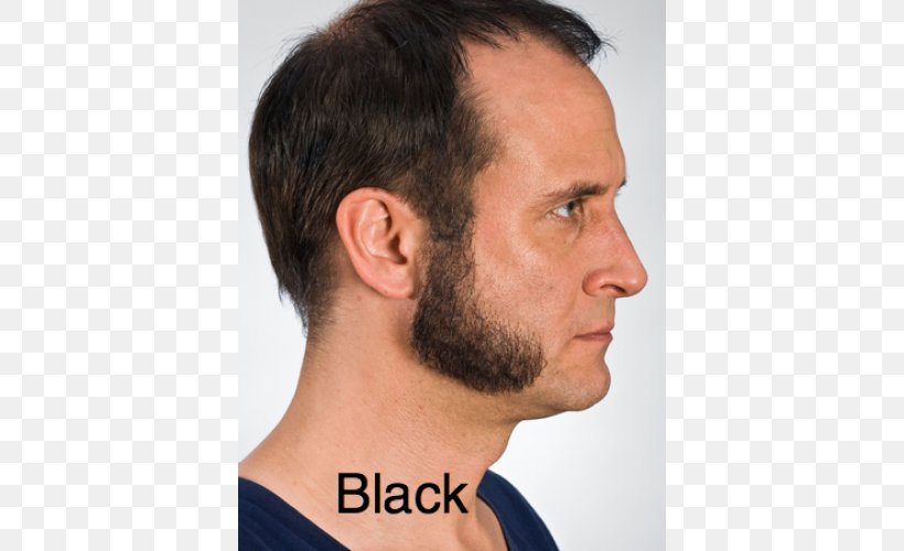 Chin Sideburns Beard Hair Coloring Hairstyle, PNG, 500x500px, Chin, Beard, Cheek, Cosmetics, Ear Download Free