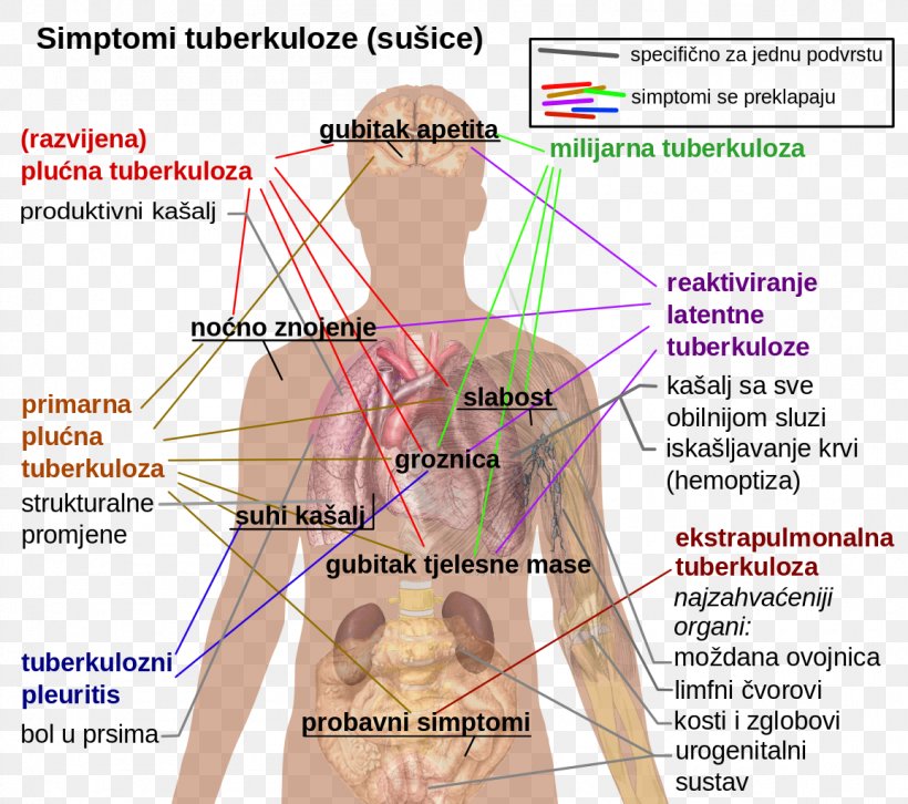 Latent Tuberculosis Infection Symptom Disease, PNG, 1155x1024px, Watercolor, Cartoon, Flower, Frame, Heart Download Free