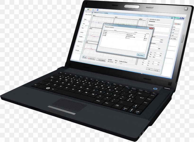 Netbook Laptop Computer Hardware Handheld Devices Price, PNG, 937x685px, Netbook, Computer, Computer Accessory, Computer Hardware, Electronic Device Download Free