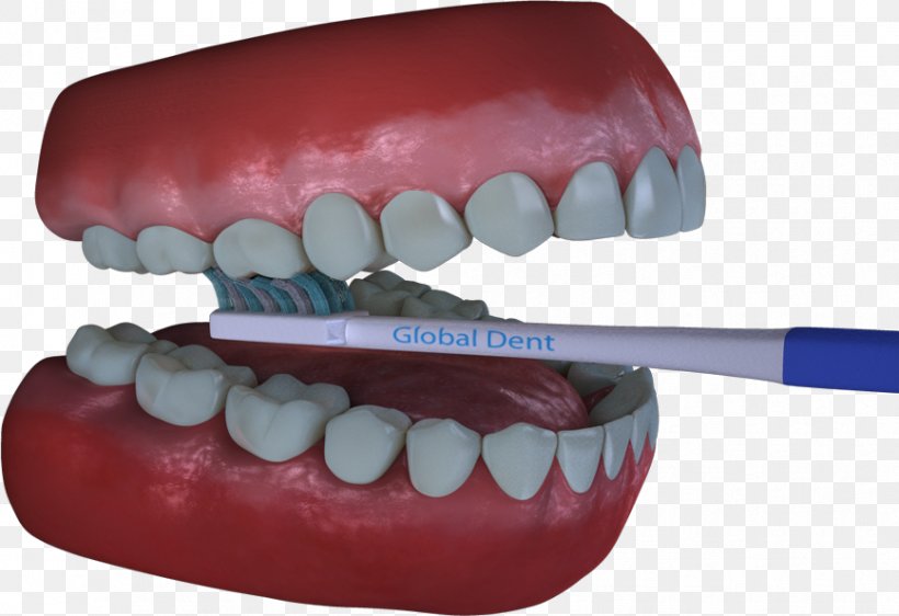 Tooth Dental Software Dentistry Computer Software, PNG, 867x595px, Tooth, Animation, Bit, Computer Software, Cosmetic Dentistry Download Free