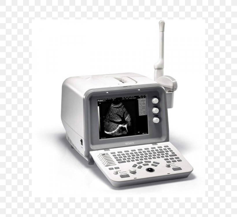 3D Ultrasound Ultrasonography Medical Equipment Voluson 730, PNG, 600x750px, 3d Ultrasound, Ultrasound, Cardiology, Computed Tomography, Electronics Download Free