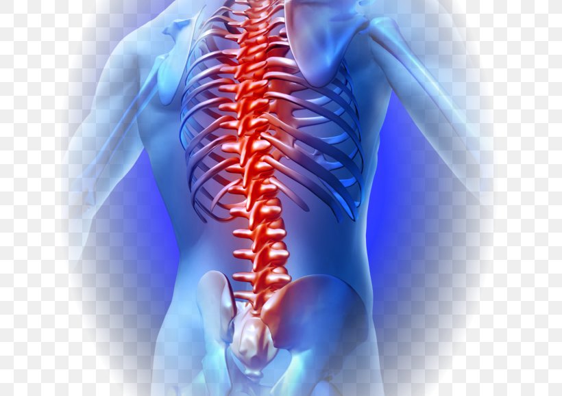 Low Back Pain Vertebral Column Human Back Neck Pain, PNG, 642x579px, Watercolor, Cartoon, Flower, Frame, Heart Download Free