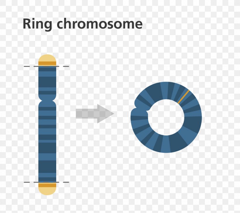 Ring Chromosome 14 Syndrome Chromosome Abnormality Genetics, PNG, 1076x956px, Ring Chromosome, Abnormality, Brand, Chromosome, Chromosome Abnormality Download Free