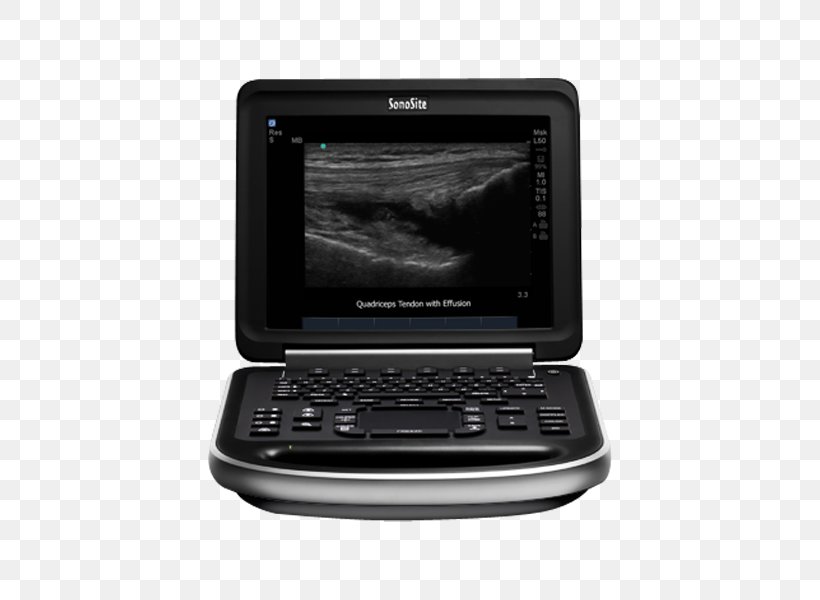 Ultrasonography Ultrasound SonoSite, Inc. Medicine Medical Imaging, PNG, 600x600px, Ultrasonography, Bildgebendes Verfahren, Diagnose, Display Device, Electronic Device Download Free