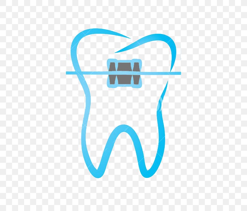 ORTHODONTICS: THE ART AND SCIENCE Clip Art Dental Braces Tooth, PNG