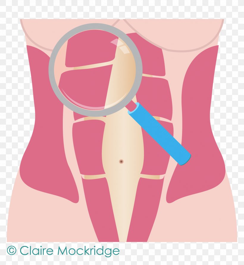 Diastasis Recti Hip Abdomen Rectus Abdominis Muscle, PNG, 1356x1478px, Watercolor, Cartoon, Flower, Frame, Heart Download Free