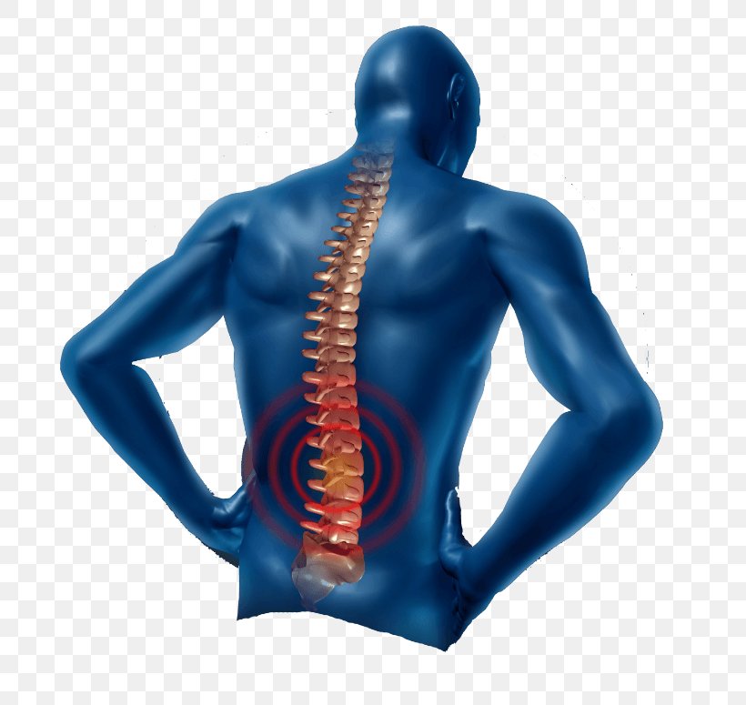 Low Back Pain Neck Pain Physical Therapy Pain Management, PNG, 775x775px, Back Pain, Arm, Back, Chronic Condition, Chronic Pain Download Free