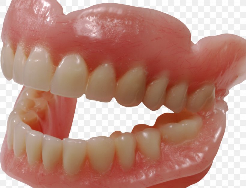 Human Tooth Dentures Clip Art, PNG, 1583x1211px, Human Tooth, Canine Tooth, Dentist, Dentistry, Dentures Download Free