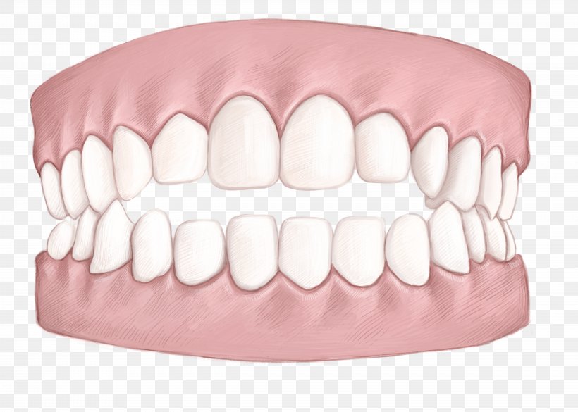 Tooth Dentistry Clear Aligners Dental Braces Mouth, PNG, 4961x3543px, Watercolor, Cartoon, Flower, Frame, Heart Download Free