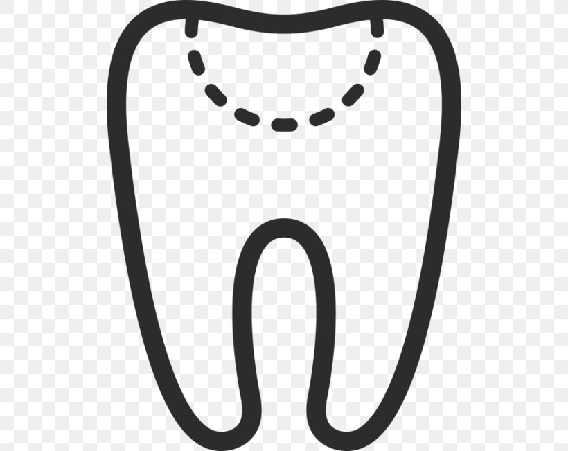 Human Tooth Tooth Decay Dentistry Smile, PNG, 512x651px, Tooth, Black, Black And White, Body Jewelry, Crown Download Free