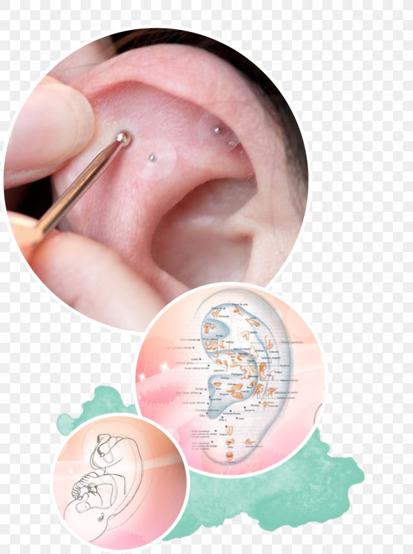 Ear Acupuncture Chart Free