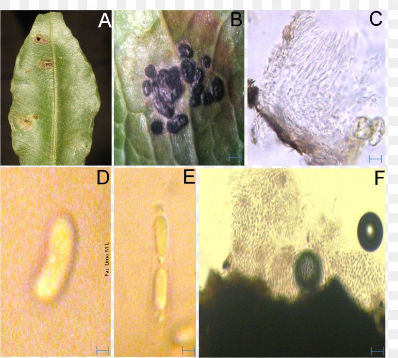 Colletotrichum Sordariomycetes Plant Pathology Fungus, PNG, 1163x1049px, Colletotrichum, Acervulus, Canker, Disease, Fauna Download Free