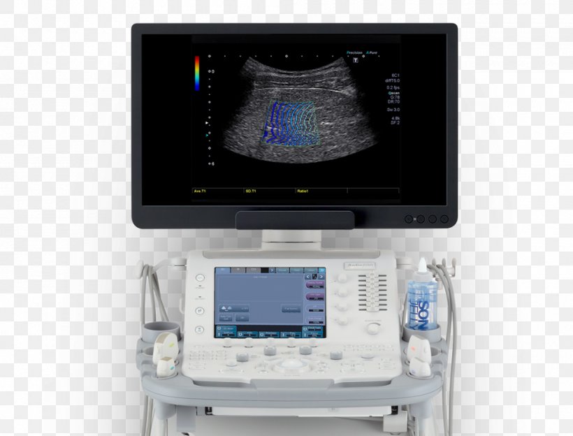 Ultrasonography Medical Equipment Medical Diagnosis Hospital Technology, PNG, 1000x762px, Ultrasonography, Canon Medical Systems Corporation, Display Device, Electronic Device, Electronics Download Free